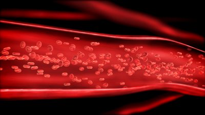 Επιτυχημένη μεταμόσχευση συνθετικής φλέβας σε 10χρονη ασθενή